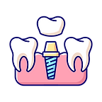 Dental Implant Consultation