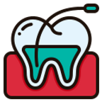 Root Canal